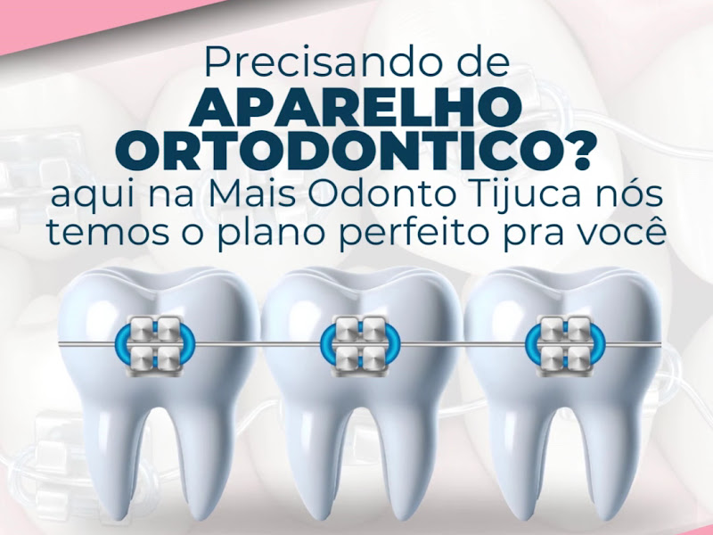 Foto 3 de Mais Odonto RJ