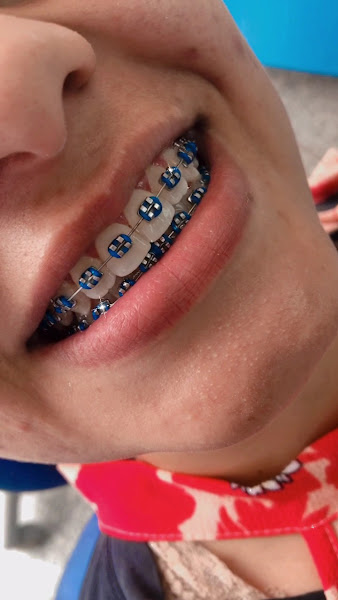 Foto 3 de Mais Saúde Odontologia