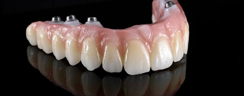 Foto 3 de Mais Sorrir Odonto