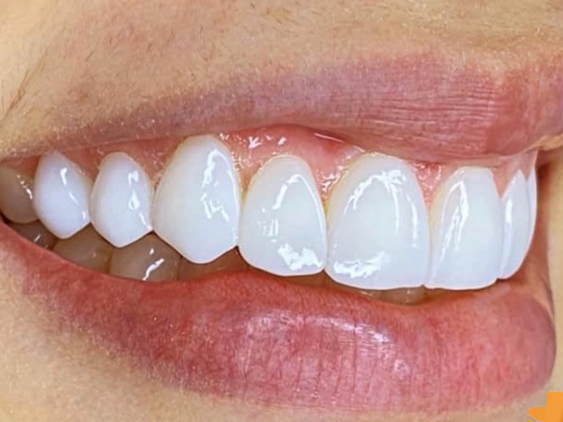 Foto 7 de Mais Sorriso Odontologia