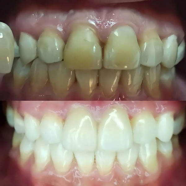 Foto 2 de Make Smile Odontologia Integrativa e Estética | Especialista em Bruxismo e Miofuncional