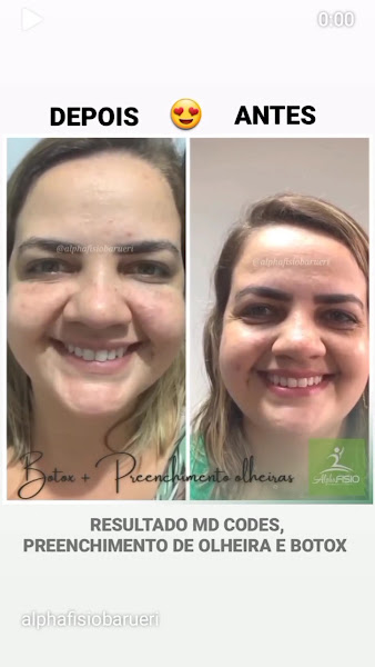 Foto 2 de Makelle Carmisini Estética Avançada Harmoniza