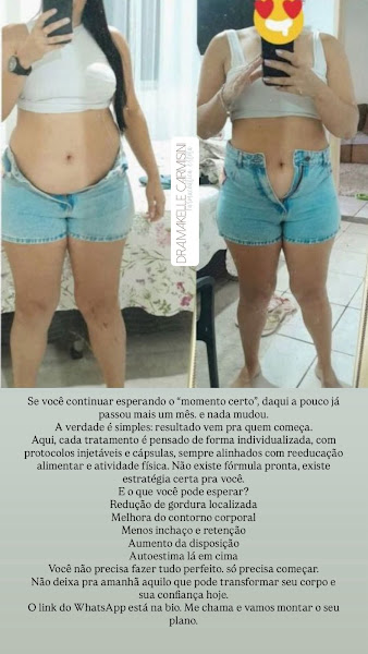 Foto 3 de Makelle Carmisini Estética Avançada Harmoniza