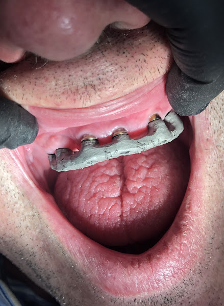 Foto 3 de Mandí Odontologia