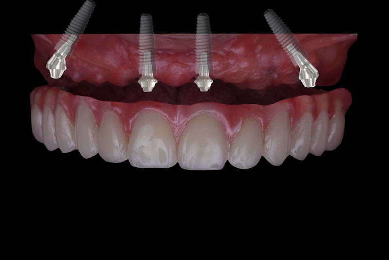Foto 2 de Manfron Odontologia