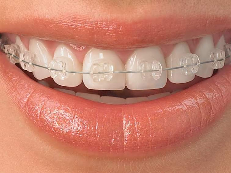 Foto 9 de MAPE Odontologia Especializada