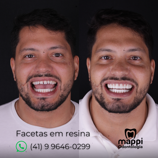Foto 2 de Mappi Odontologia - Centro Curitiba
