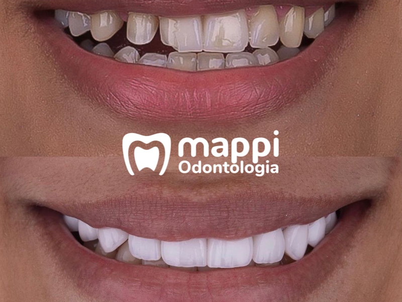 Foto 6 de Mappi Odontologia - Centro Curitiba