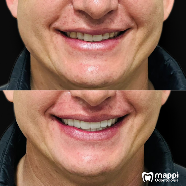 Foto 3 de Mappi Odontologia - Clínica Odontológica em Itajaí