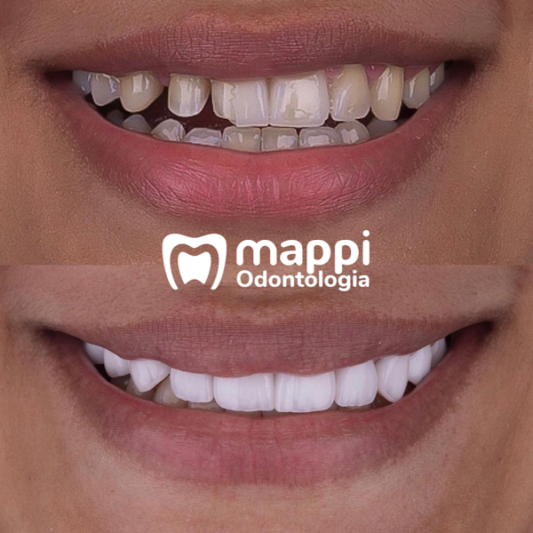 Foto 2 de Mappi Odontologia - Pinheirinho Curitiba | Implante Dentário | Prótese Dentaria