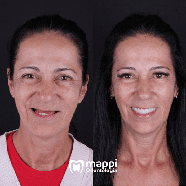 Foto 3 de Mappi Odontologia - Pinheirinho Curitiba | Implante Dentário | Prótese Dentaria