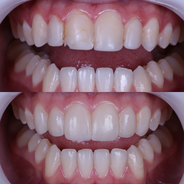 Foto 2 de MARANATA Odontologia e Harmonização Orofacial
