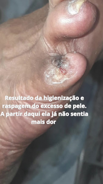 Foto 3 de Marcela Podologia - Espaço Amare