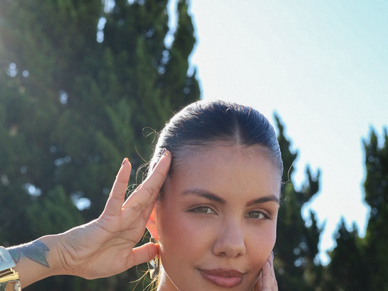 Foto 2 de Marcella Naresi | Harmonização Facial Taubaté