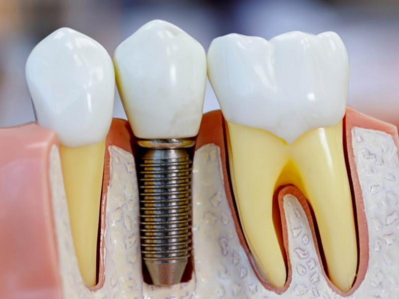 Foto 7 de Marcelo Giordani da Rosa