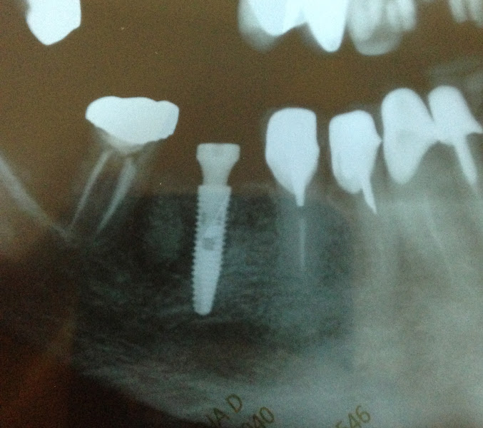 Foto 3 de Marcelo Merlo Odontologia