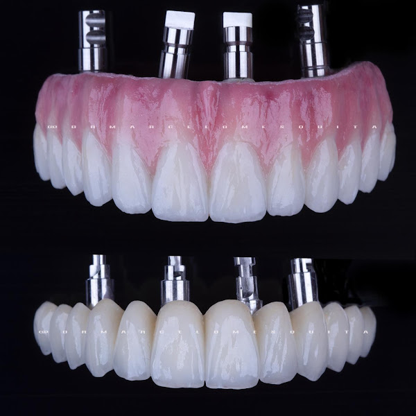 Foto 3 de Marcelo Mesquita Odontologia Especializada