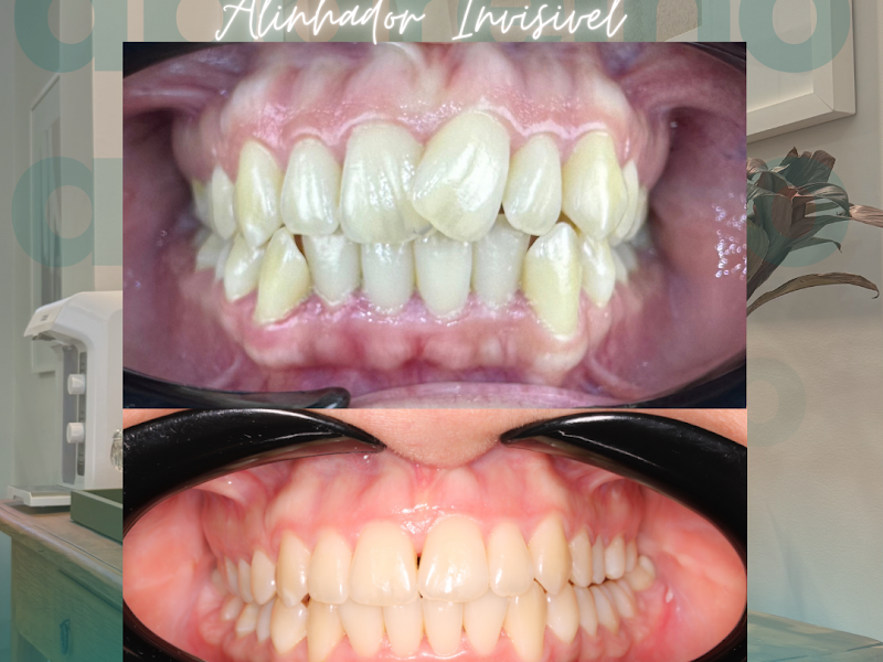 Foto 2 de Marcelo Muscas Polimeno