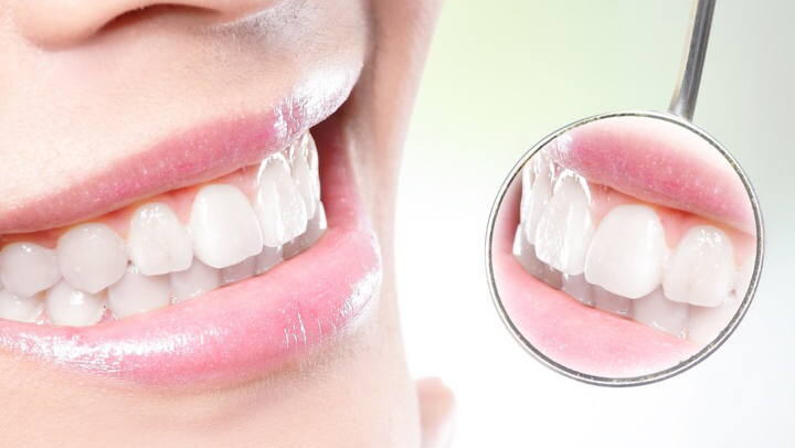 Foto 3 de Marchiori Odontologia Dentista Invisalign Ortodontia Aparelho Ortodôntico Varginha MG