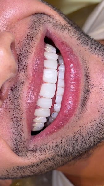 Foto 2 de Marcia Morais Odontologia