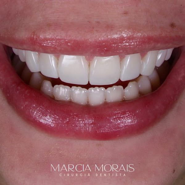 Foto 3 de Marcia Morais Odontologia
