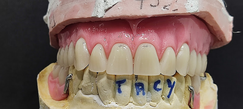 Foto 2 de Marcone Estevam - Prótese dentária -Laboratório e Centro de Treinamento Recife