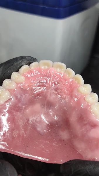 Foto 3 de Marcone Estevam - Prótese dentária -Laboratório e Centro de Treinamento Recife