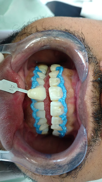 Foto 2 de Marcos Pereira Odontologia