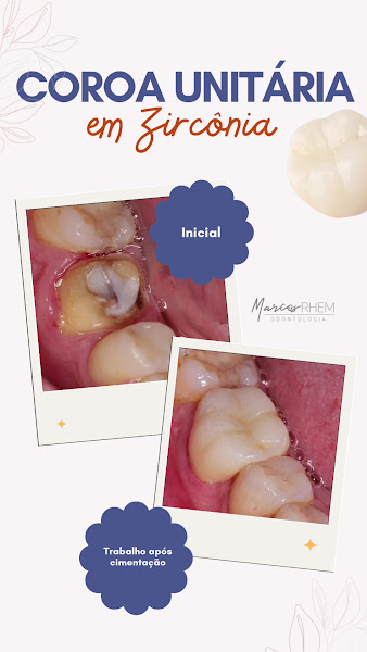 Foto 4 de Marcos Rhem Odontologia