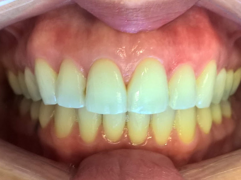 Foto 2 de Marcus Lima Verde