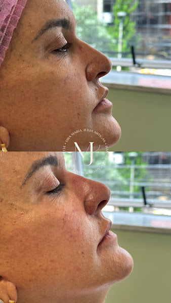 Foto 3 de Maria Julia Artigas - Harmonização Orofacial