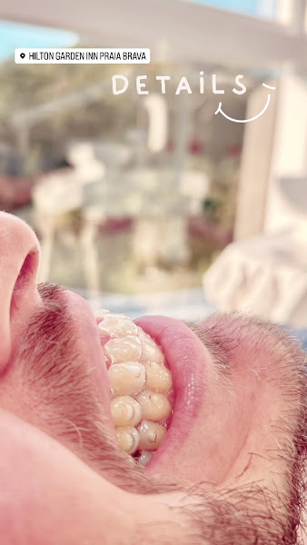 Foto 3 de Mariana Brun Odontologia | INVISALIGN