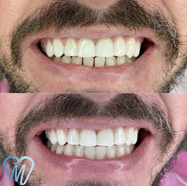 Foto 2 de Marin Odontologia