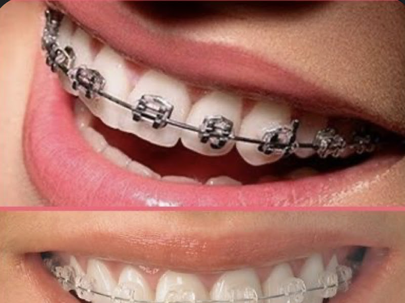 Foto 6 de Maringolo Odontologia Integrada