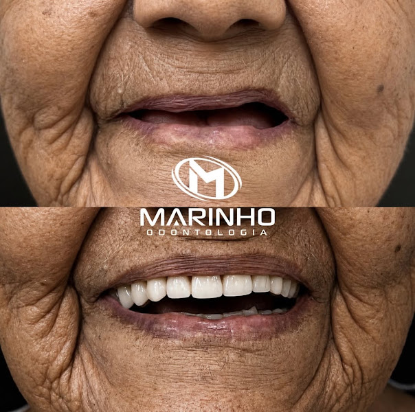 Foto 2 de Marinho Odontologia - Nova Parnamirim