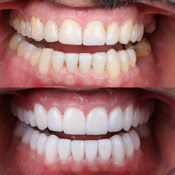 Foto 2 de Martini Centro de Saúde Rio Verde l Implante Dentário - Próteses - Harmonização Facial Rio Verde