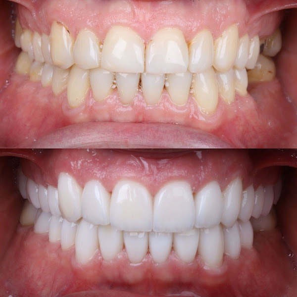 Foto 3 de Martini Centro de Saúde Rio Verde l Implante Dentário - Próteses - Harmonização Facial Rio Verde