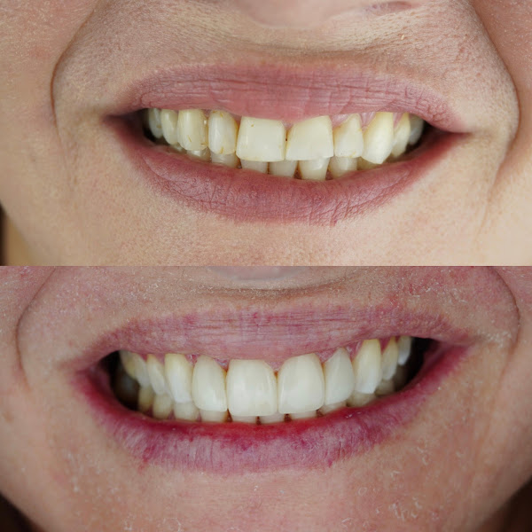 Foto 2 de Mary Odontologia - Dentista em Cacoal