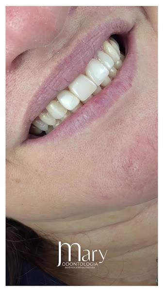 Foto 3 de Mary Odontologia - Dentista em Cacoal