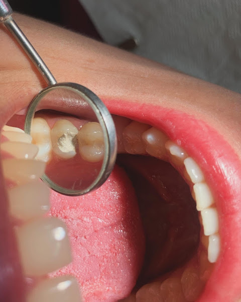 Foto 3 de Marzola odontologia Bauru 24 horas