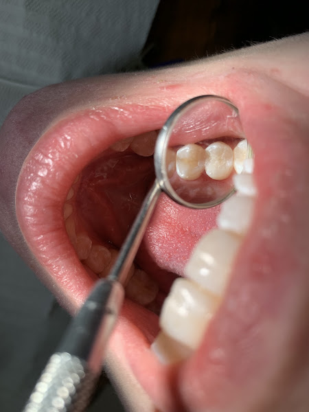 Foto 4 de Marzola odontologia Bauru 24 horas