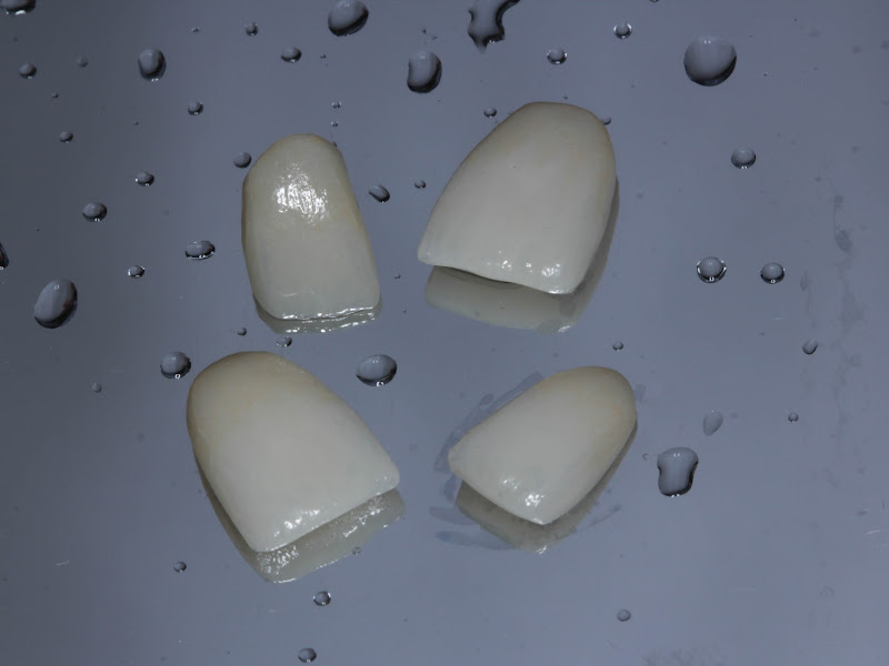 Foto 9 de Marzola odontologia Bauru 24 horas