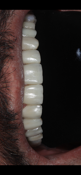 Foto 3 de Massoni Odontologia