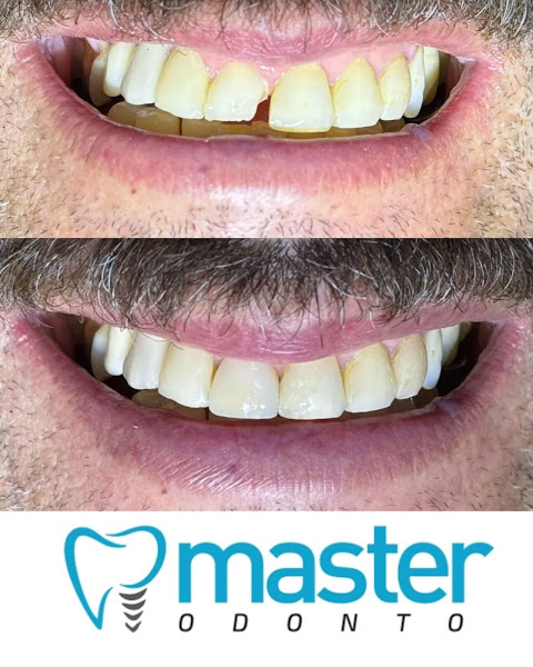 Foto 2 de Master Odonto - Clínica Odontológica Especialista Em Implantes - Governador Valadares