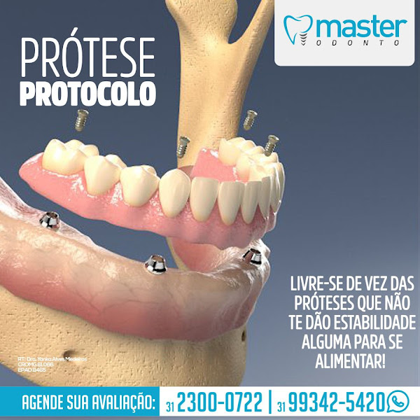 Foto 3 de Master Odonto Ipatinga - Clínica Odontológica Especializada - Implantes Dentários