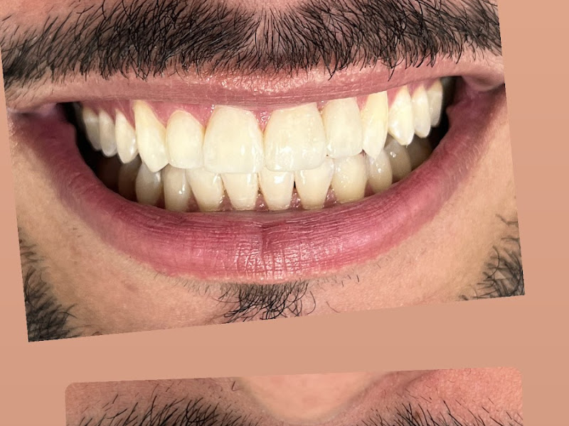 Foto 8 de Master Odonto Ipatinga - Clínica Odontológica Especializada - Implantes Dentários