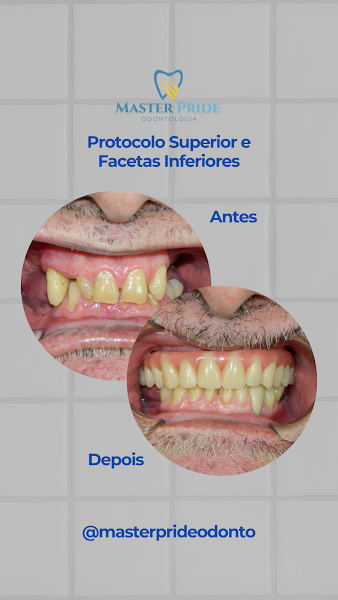 Foto 4 de Master Pride Odontologia (Dra Bianca Rosa)