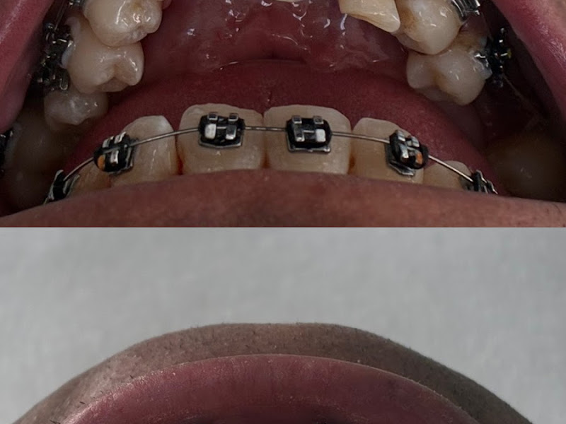 Foto 7 de Master Pride Odontologia (Dra Bianca Rosa)