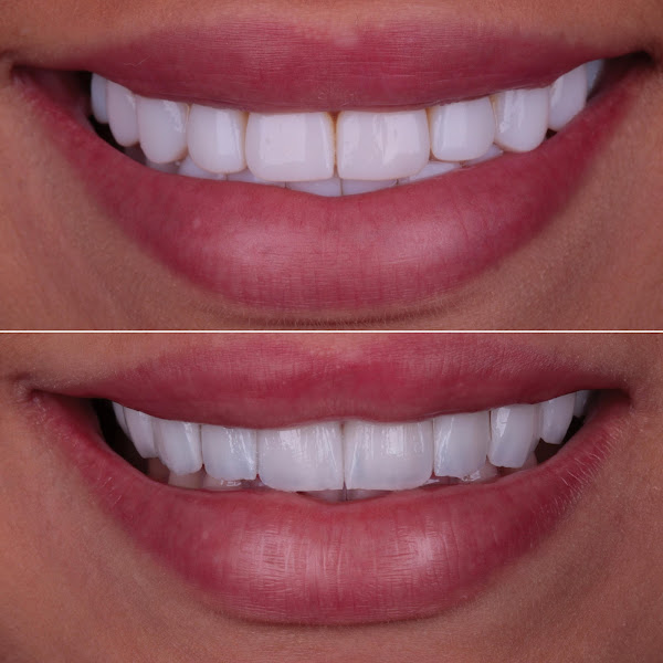 Foto 3 de Matheus Lima Odontologia