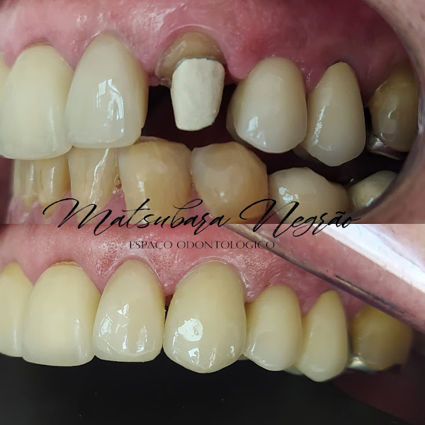 Foto 3 de Matsubara Negrão Odontologia Estética - São José dos Campos